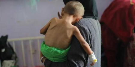 ارتفاع وفيات التجويع في غزة إلى 422 بينهم 145 طفلًا - تليجراف الخليج