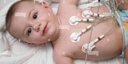 تخطيط كهربية القلب الطبيعي..هل يعني أن قلبك سليم بالكامل؟ - تليجراف الخليج