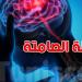 الجلطة الصامتة: مرض خطير يصيبك ماغير ما تحس! شنوّة علاماته؟ - تليجراف الخليج